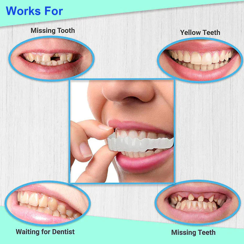 Snap On Braces | Special Teeth whitening Cover